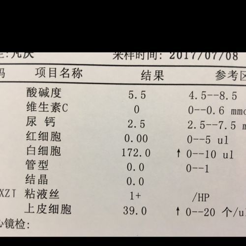 尿白细胞偏高是什么意思(尿白细胞偏高严重吗)-第1张图片-