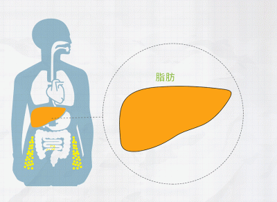 ​吃什么养肝补肝（养肝就是养命，想要“养肝”，得经常吃这3种食物）