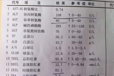 ​体检转氨酶高复检检查哪些指标 体检转氨酶偏高复检查什么